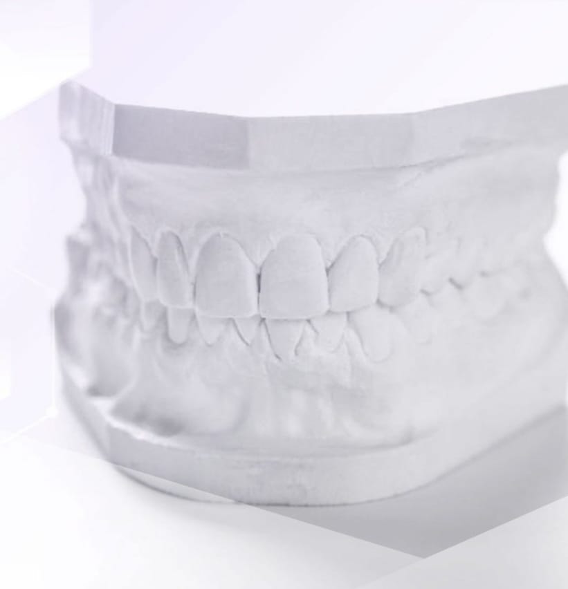 Modelos de estudio y trabajo para el Diagnostico tanto en Ortodoncia como en Rehabilitación Oral.